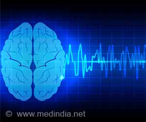 Dementia Risk Higher in Atrial Fibrillation Patients With Carotid Artery Disease
