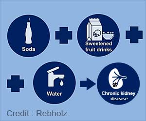 Sugar-sweetened Beverage can Put You at a Higher Kidney Disease Risk
