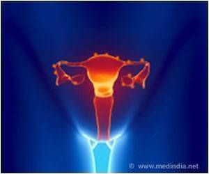 Link Between Endometriosis and Ovarian Cancer