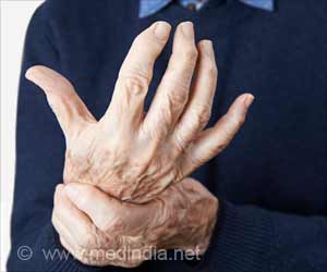 Rheumatoid Arthritis Connection With Huntingtons Disease Discovered