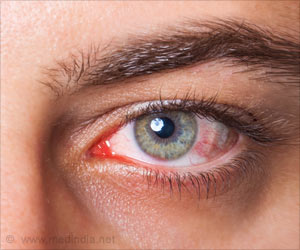 COVID-19 Impact on Eye Health: Rising Cases of Ocular Symptoms