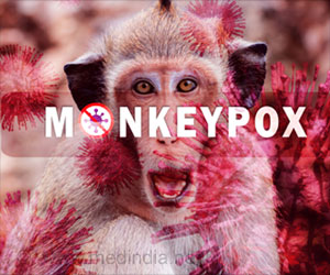 Ulcer at Corner of the Mouth: First Sign of Monkeypox?