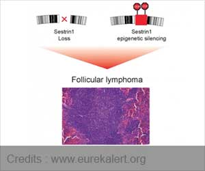 Follicular Lymphoma : Sestrin1 Gene Link Detected