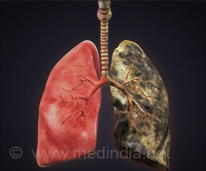 Predicting Risk for Chronic Obstructive Pulmonary Disease