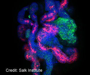 Growing a New Kidney Chances Now Higher Due to a New Technique That can Supply Endless Number of Kidney Cells