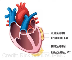 Heart Fat Associated With Higher Risk of Heart Disease in Postmenopausal Women