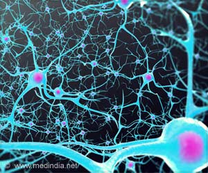 Combustion Nanoparticles: Culprit Hidden in Alzheimers Disease
