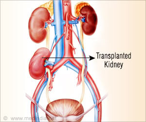  Kidney Donation Safe for Healthy Older Adults - Implications in India