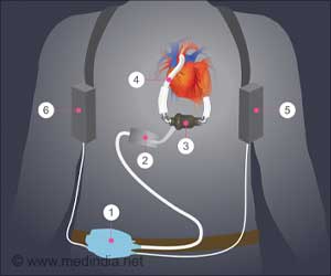 The Life Saving Battery Heart of Sofia Hart