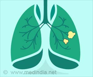 Lung Cancer Awareness Month - Improving Lung Cancer Survival