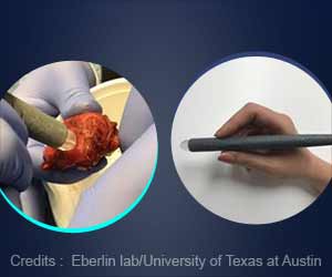 MasSpec Pen can Detect Cancer During Surgery Accurately