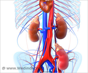  Metabolic Syndrome Guidelines Reduce Cardiovascular Risk Among Kidney Transplant Recipients