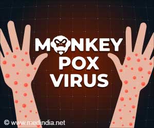 Monkeypox Detected in South Africa