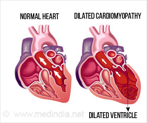 Can heart attack damage be reversed? • MyHeart