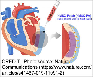 New Dual Stem Cell Therapy Holds Promise for Heart Regeneration