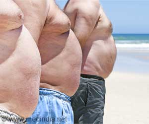  Will Half the World Be Obese by 2050?