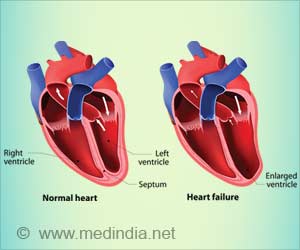 Sacubitril/Valsartan and Ivabradine: Promising Drugs for Severe Heart Failure