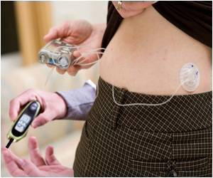 Benefits of Insulin Pump in Children With Type 1 Diabetes