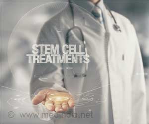 Stem Cell Therapy in Perianal Fistula Associated with Crohns Disease
