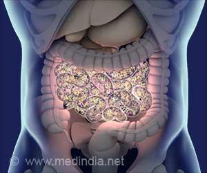 Gut Bacteria Diversity Affected by Polycystic Ovarian Syndrome