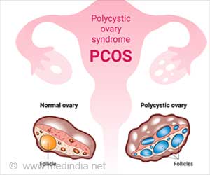 COVID-19 Risk Doubles in Polycystic Ovary Syndrome