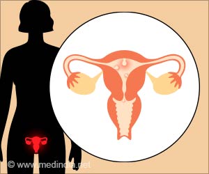 Combining Immunotherapy and Chemotherapy Reduces Endometrial Cancer Growth