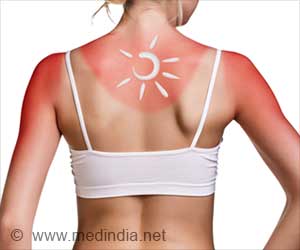Tanning Vs. Sunburn: Understanding Your Skin's Response to UV Rays