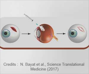 Temperature-sensitive Hydrogel Developed to Fix Eye Injuries