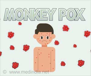 One Lesion may also Signal Monkeypox Infection