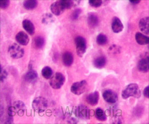 Rabbit Virus Eliminates Multiple Myeloma Cells