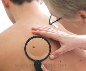 New Test to Detect Merkel Cell Carcinoma Recurrence