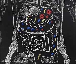 Common food additive may impact gut bacteria, increase anxiety