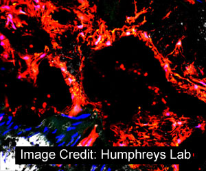 Stem Cells Behind Calcified Blood Vessels in Kidney Disease Identified