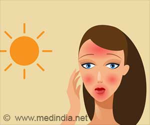Sun and Skin: What Does Sun-Damaged Skin Look Like?
