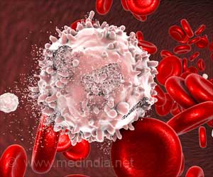 New T-cell Leukemia Target Mutations Identified