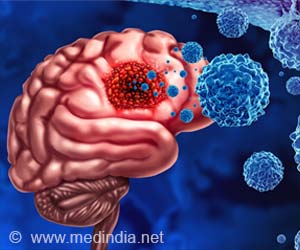 Endocan: A Breakthrough Target for Glioblastoma Treatment