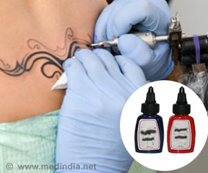 Complications of Tattooing and Scarring  SpringerLink