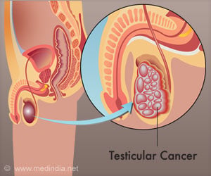 Standardized Care Help Equalize Health Outcomes Among Patients with Testicular Cancer
