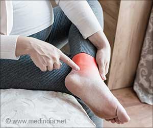Leg Swelling: A Subtle Sign of Heart Disease You Shouldn't Ignore