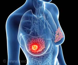 Naturally Occurring Protein Controls Growth and Spread of Triple Negative Breast Cancer