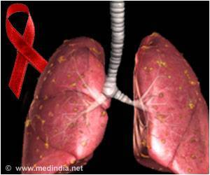 Newer Treatments to Avert Tuberculosis in HIV Infected Adults