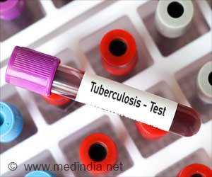 Novel Portable Solution for Tuberculosis Diagnosis