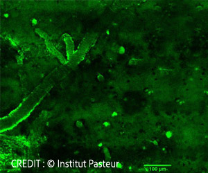 Alzheimers Disease Related Cerebral Lesions Could Be Detected Using Llama Antibodies