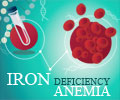 Iron Deficiency Anemia in Kidney Disease can be Treated With Oral ...