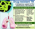 Multi-drug Resistant Tuberculosis (MDR-TB)