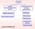 Optic Neuritis - Causes