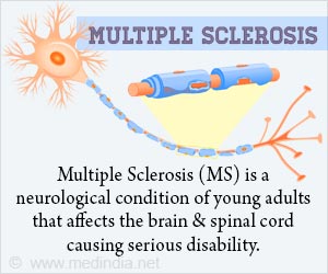 Depression, Constipation & UTI: Early Signs of Multiple Sclerosis