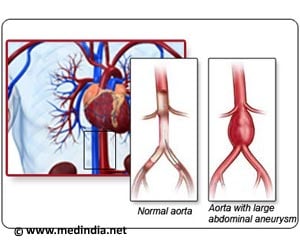 Takayasu Arteritis