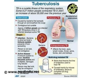 Tuberculosis - Spread - Symptoms - Diagnosis - Treatment - FAQs