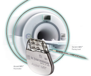 St. Jude Medical Launches Accent MRI Pacemaker In India - Print